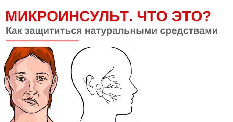 Микро инсульт симптомы. Микроинсульт. диагноз микроинсульт. бывает ли микроинсульт. микроинсульт у мужчин.