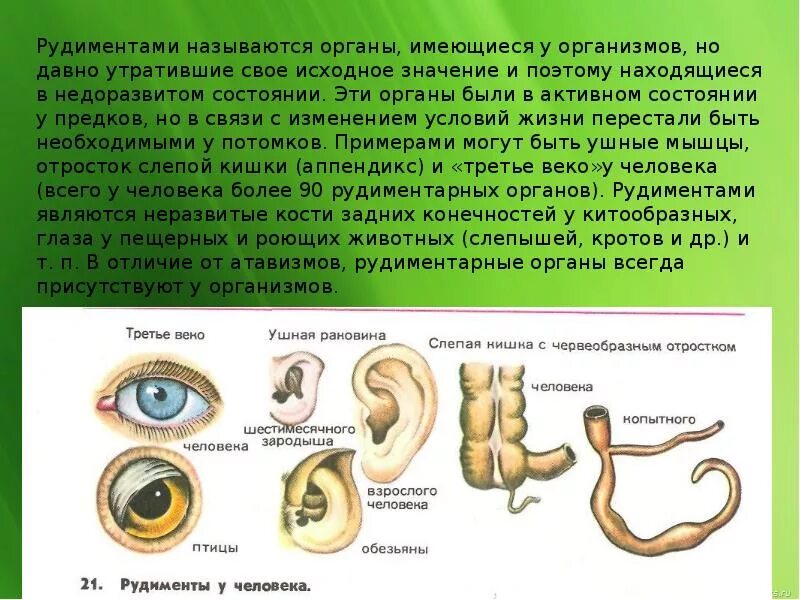 Аппендикс является рудиментом. Рудименты и атавизмы доказательства эволюции. Органы рудименты у человека. Рудиментарные органы человека примеры.