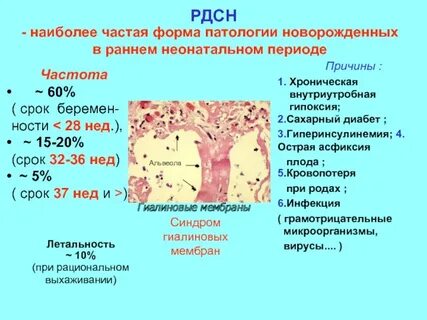 Респираторный дистресс новорожденных