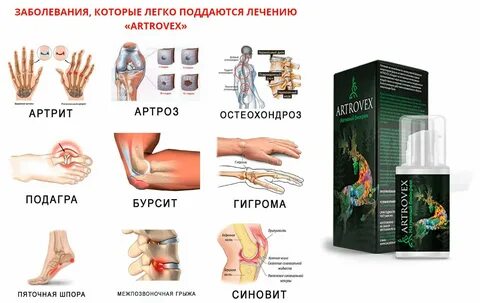 Ревматизм суставов симптомы и лечение какие таблетки