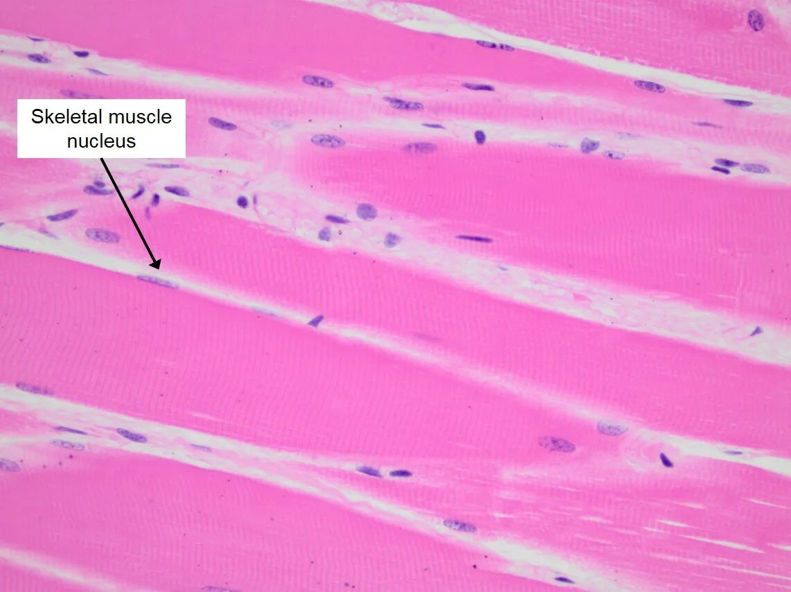 Скелетная мышечная ткань гистология. Гладкая мышечная ткань muscular Tissue. Гладкая мышечная ткань гистология. Поперечно полосатая мышечная гистология. Гладкая мышечная ткань в дерме