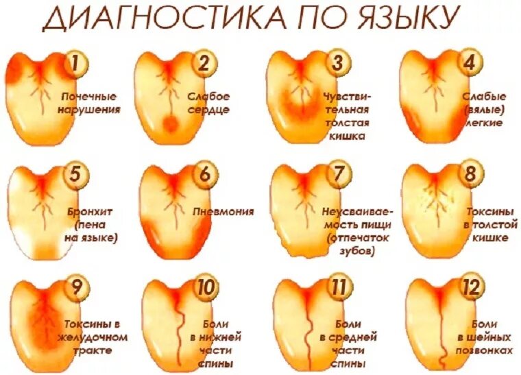 О чем говорит диагноз. Желучный налет на языке.