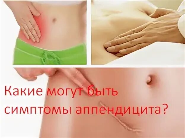 Аппендицит с какой стороны у взрослых женщин. Аппендицит с какой стороны у взрослых женщин