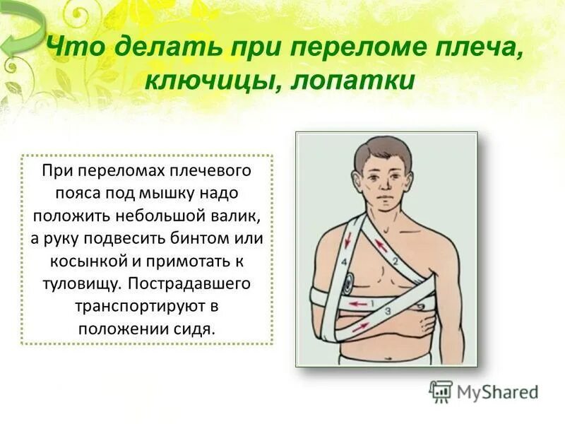Перелом плеча помощь. Транспортная иммобилизация при переломе ключицы. первая помощь при переломе плеча. оказание первой помощи при переломах вывихах ушибах. неотложная помощь при вывихе плеча.
