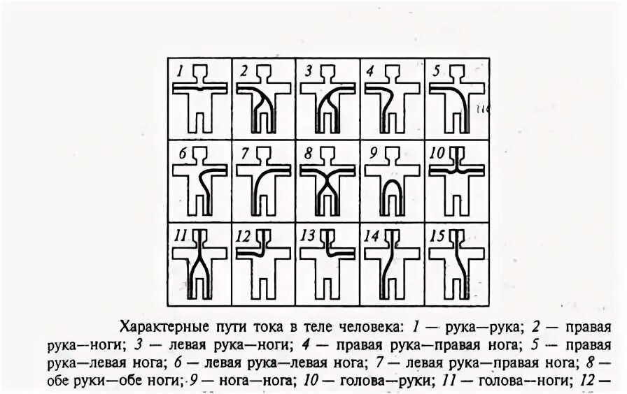 Какие петли тока наиболее опасны. Схемы пути прохождения тока через тело человека. Наиболее опасный путь тока через тело человека. Схема протекания тока через организм человека. Характерные пути тока в теле человека схема.