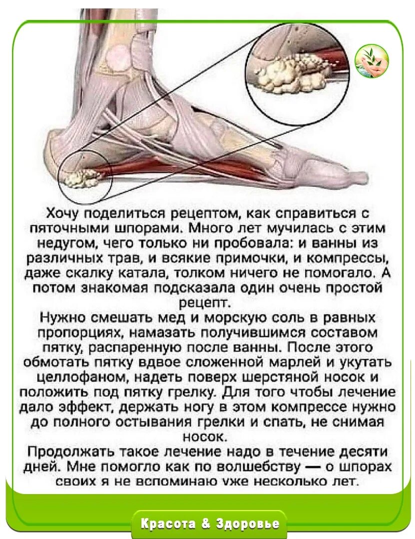 Почему болит пятка ноги когда наступаешь