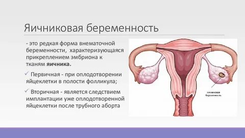 Опухоли яичников беременность