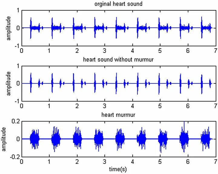 Функциональные шумы сердца, данные ФКГ. Классификация шумов сердца пропедевтика. Функциональный систолический шум. Патологические шумы сердца. Сердечные тоны шумы