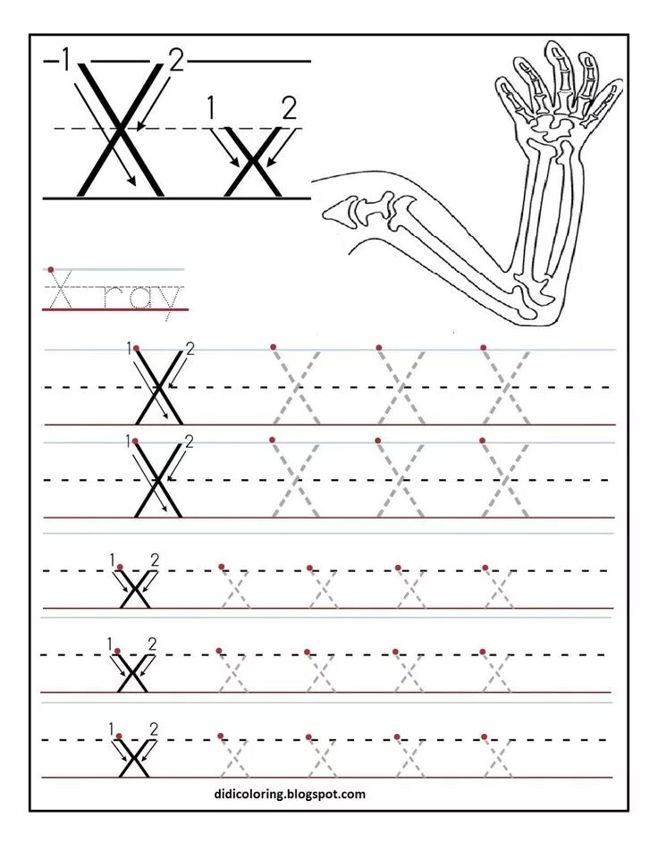 Z tracing