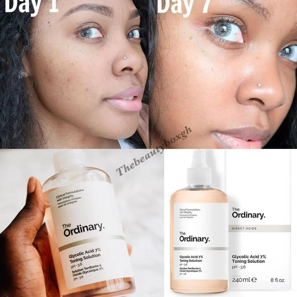 The ordinary тоник с гликолевой кислотой Glycolic acid 7% Toning solution. Гликолевый тоник 7% the ordinary – 240 мл. Glycolic acid 7% - гликолевый тонер 240 ml. Гликолевый тонер Glycolic acid 7% Toning solution, 240ml (the ordinary).