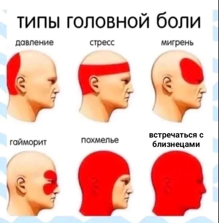 Сильная боль лобной. Виды головной боли. Причины головной боли. Головная боль локализация. Локализация глазной боли.