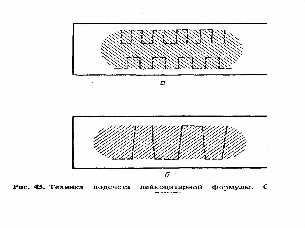 Подсчет лейкоцитарной формулы вручную. Подсчет лейкоцитарной формулы. Дифференцированный подсчет лейкоцитов лейкоцитарная формула норма. Методика подсчета лейкоцитарной формулы. Техника подсчета лейкоцитарной формулы.