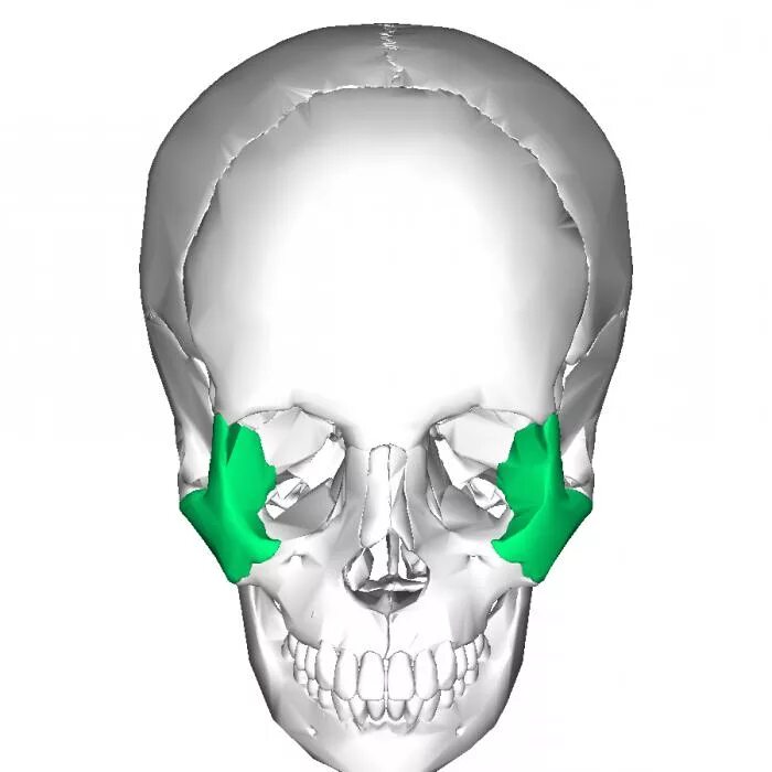 Перелом лицевого черепа. Перелом скуловой кости. Переломы скуло-верхнечелюстного комплекса. Скуловая кость отдел черепа. Скуловая дуга анатомия.