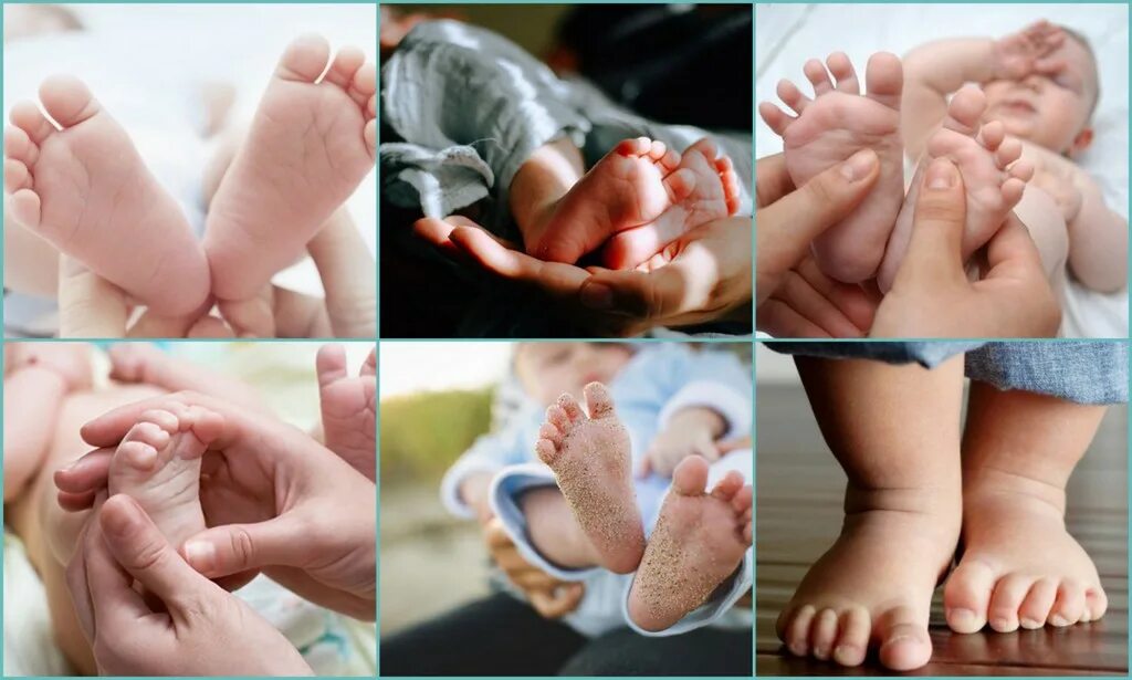 Ножки новорожденного. Гипергидроз стопы у детей. Гипергидроз ладоней и стоп у детей.