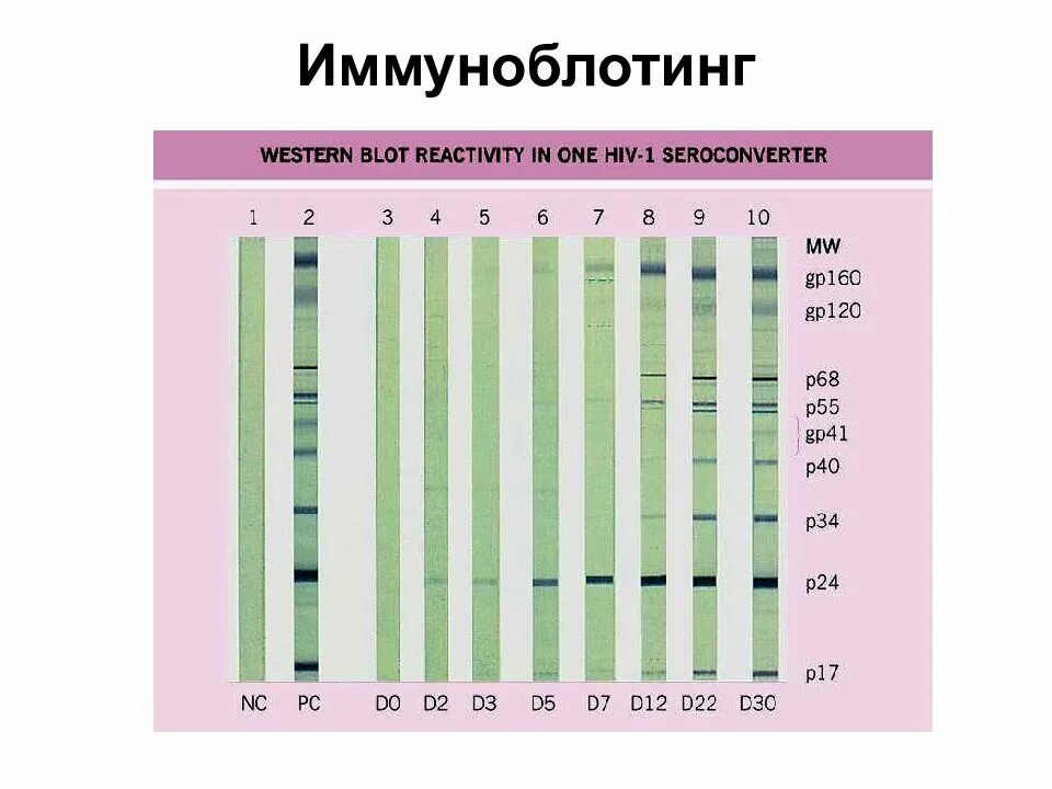 Иммунный блоттинг. Иммуноблоттинг микробиология. Иммунный блоттинг на ВИЧ. Метод иммуноблоттинга при ВИЧ. Иммуноблоттинг микробиология этапы.