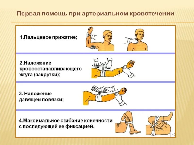 Первая помощь при наружных кровотечениях тест. Первая помощь при артериальном кровотечении. 3.Первая помощь при артериальном кровотечении.. Первая помощь в случаях артериального кровотечения. Цель к проекту на тему первая помощь при артериальном.