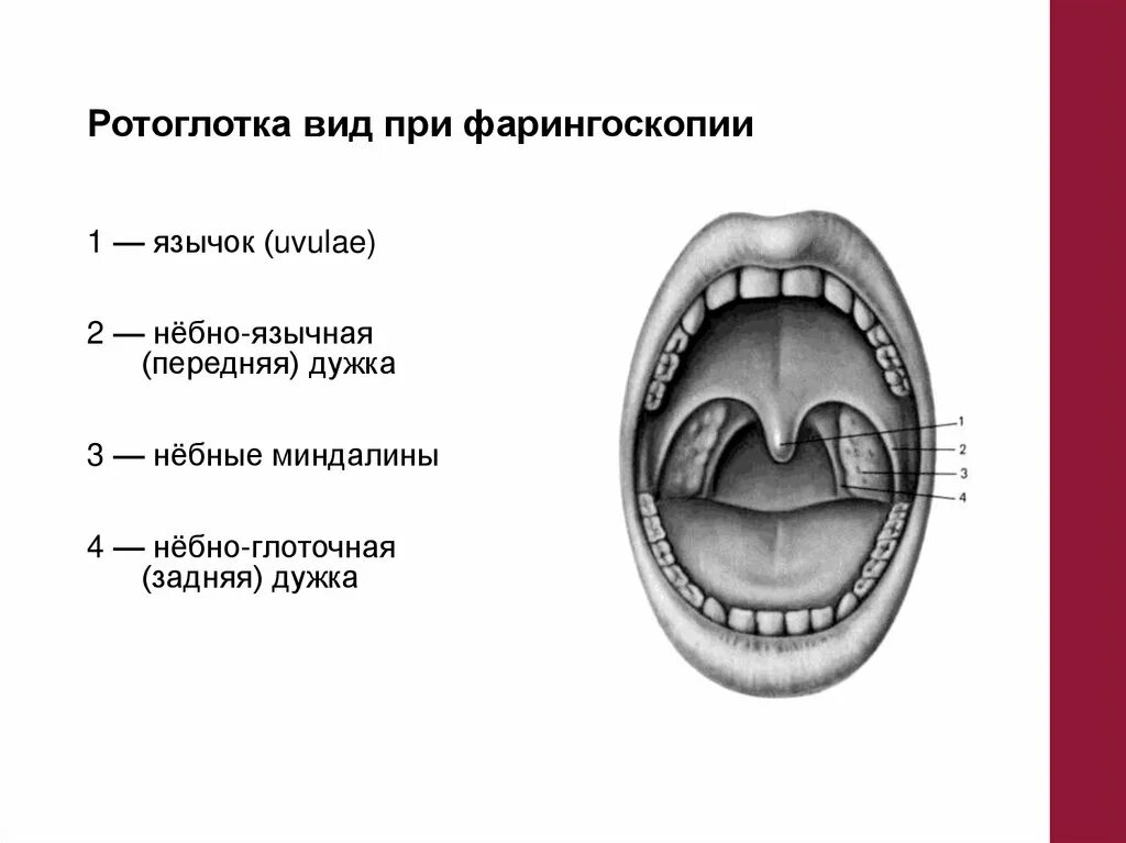 Язычная и небная миндалина. Кт миндалин