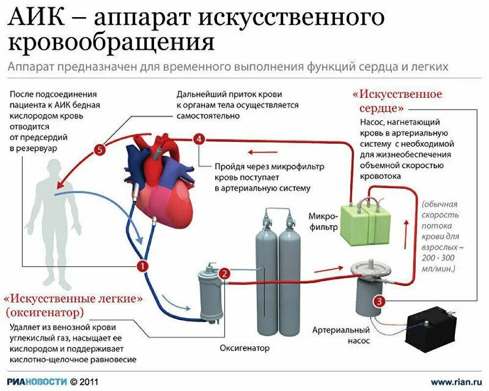 Схема подключения аппарата искусственного кровообращения. Аппарат искусственного кровообращения структурная схема. АИК аппарат искусственного кровообращения. Аппарат искусственного кровообращения принцип работы схема. Сколько человек обеспечит кислородом