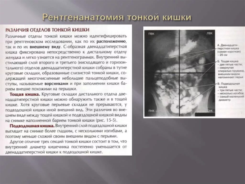 Тончайшее отличие. Рентгеноскопия тонкой Кишк. Методики рентгенологического исследования тонкой кишки. Пассаж бария по тонкому кишечнику рентген описание. Рентген кишечника описание.