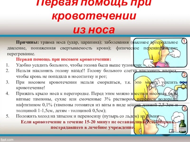 Сильно пошла кровь из носа. Оказание первой помощи при травме носа. Оказание первой помощи при носовом кровотечении. Принципы оказания неотложной помощи при носовом кровотечении. Оказание помощи при носовом кровотечении больному.