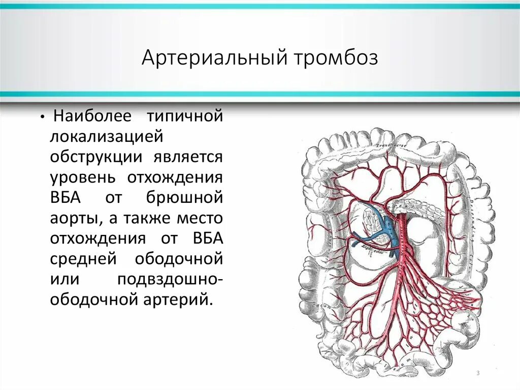 Мезентериальные сосуды кишечника. Мезентериальный тромбоз клиника. Атеросклероз мезентериальных артерий. Сегменты мезентериального тромбоза. Тромбоз артерий верхних