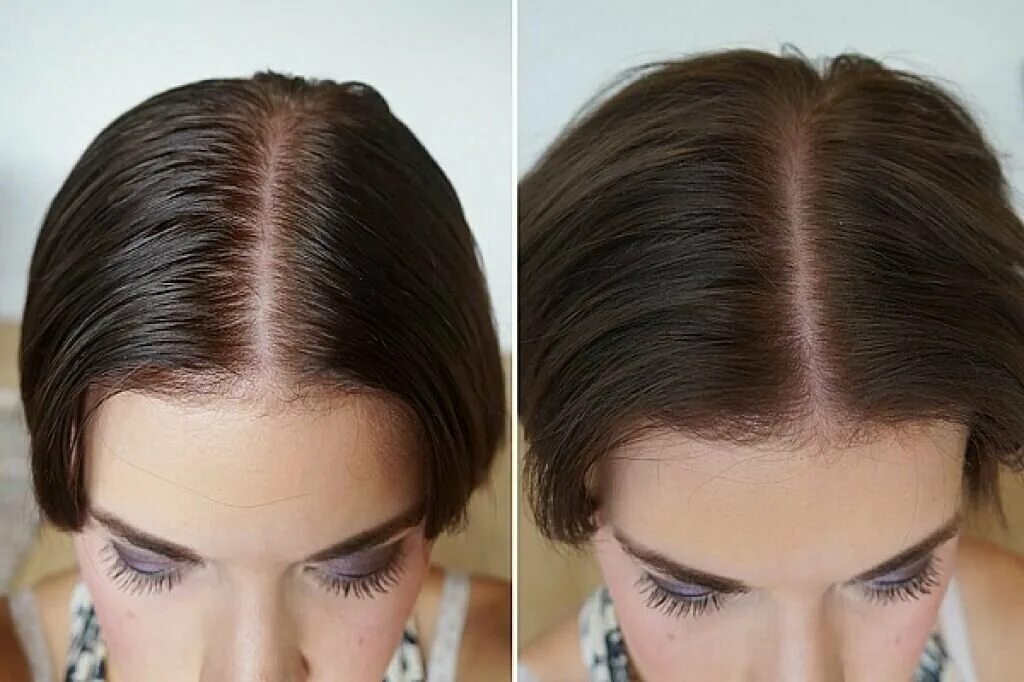 Сухой шампунь до и после. Шампунь для сухих волос. Сухой шампунь для волос до и после. Широкий пробор на голове у женщин.