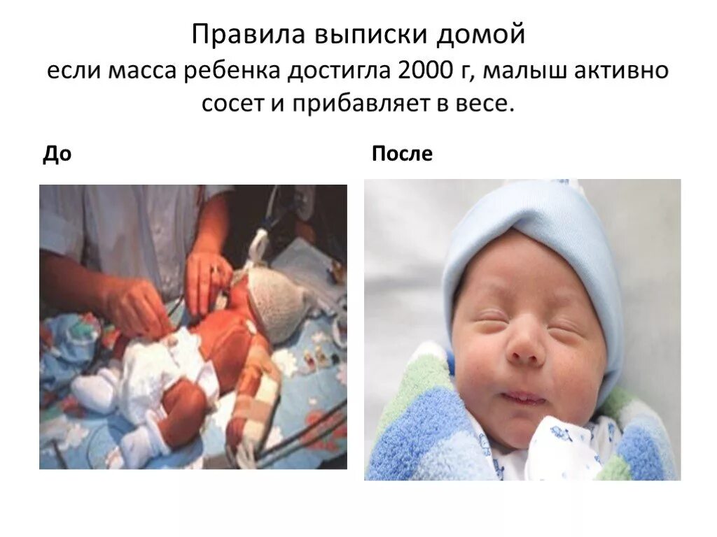 Выписывается домой