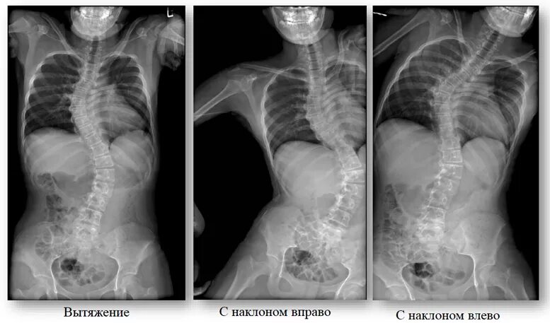 После флюорография можно можно кт делать. Флюорография и рентген отличия. Рентгеновская томограмма грудной клетки. Рентгенография рентгеноскопия флюорография. Рентген флюорография кт.