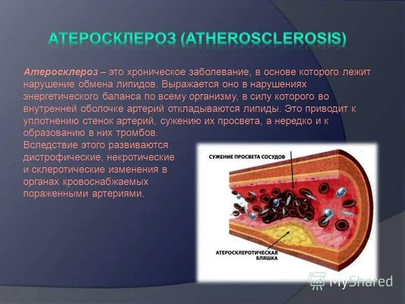 Атеросклероз причины возникновения. Для атеросклероза характерно. Для атеросклероза характерно. Атеросклероз сосудов ишемическая болезнь. Атеросклероз задачи.