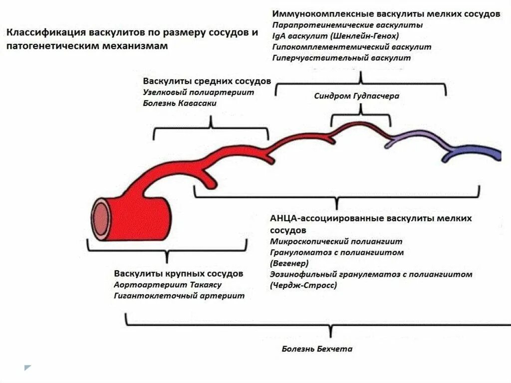 Васкулиты терапия. Геморрагический васкулит патогенез схема. Системные васкулиты патогенез схема. Патогенез болезни Шенлейн-Геноха. Васкулиты классификация этиология.