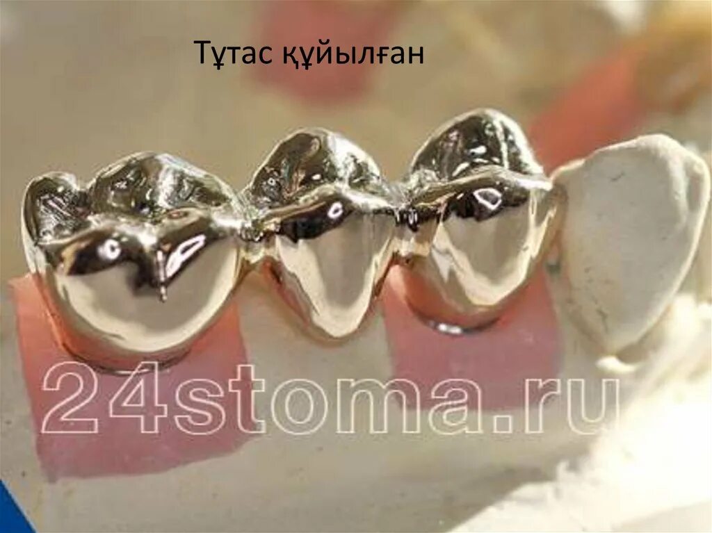 Коронка цельнолитая (никель хром). Коронка цельнолитая (сплав remanium). Цельнолитые мостовидный протез. Штампованные мостовидные протезы. Штампованно паянные.