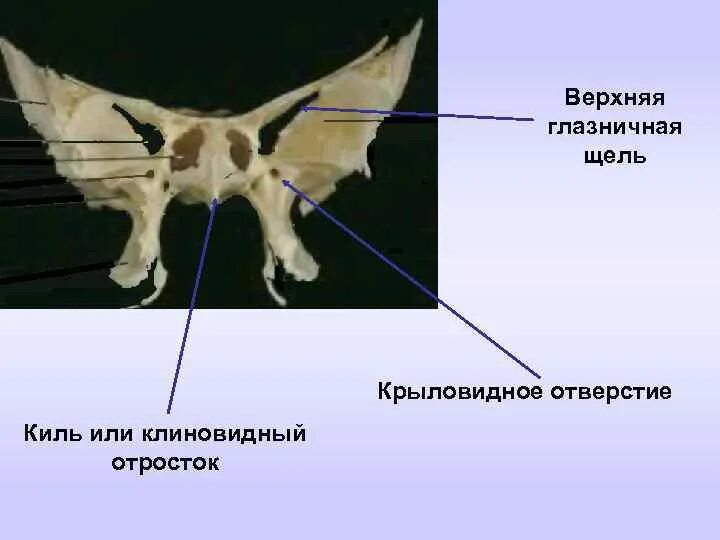 Клиновидная кость анатомия вид спереди. Клиновидная кость большое крыло. Клиновидная кость вид спереди. Крыловидная кость анатомия. Анатомия клиновидной кости черепа.