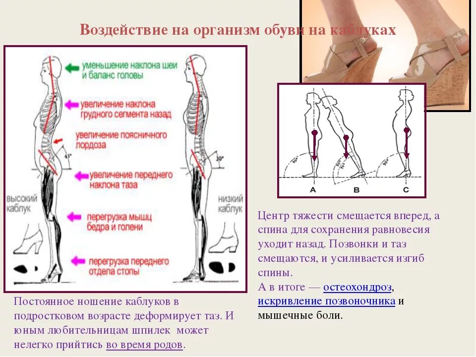 Изменение положения женщины. Влияние каблуков на позвоночник. Влияние каблуков на осанку. Влияние каблуков на организм. Влияние каблука на стопу.