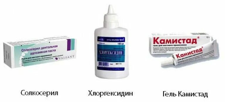 Лекарство от воспаления десен у взрослых. При заболевании десен лекарства. воспаление десен лекарство. препараты от гингивита у взрослых. лекарство от гингивита для детей.