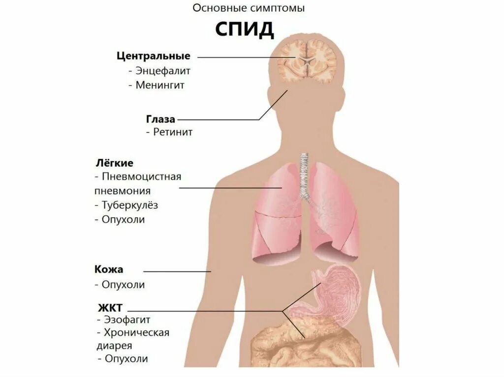 Спящий спид