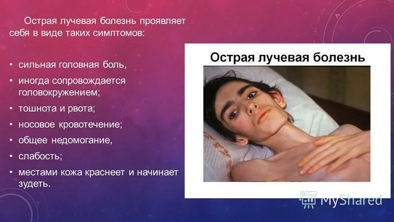 лучевая болезнь рвота. по тяжести поражения различают лучевые болезни:. острая и хроническая лучевая болезнь. степени тяжести заболевания. острая и хроническая лучевая болезнь.
