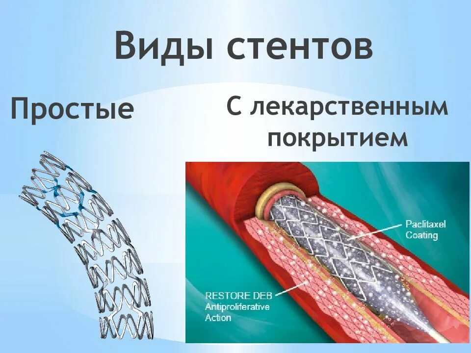 Стентирование противопоказания. Стент с лекарственным покрытием. Покрытые стенты для коронарных сосудов. Стентов коронарных с лекарственным покрытием. Типы стентов для коронарных сосудов.