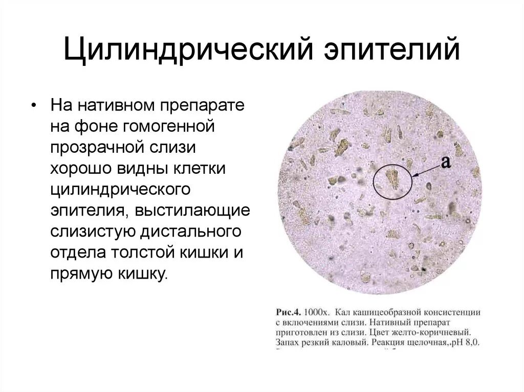 Цилиндрический эпителий микроскопия кала. Клетки цилиндрического эпителия в Кале. Клетки цилиндрического эпителия в мокроте. Реснитчатый эпителий в нативном препарате.