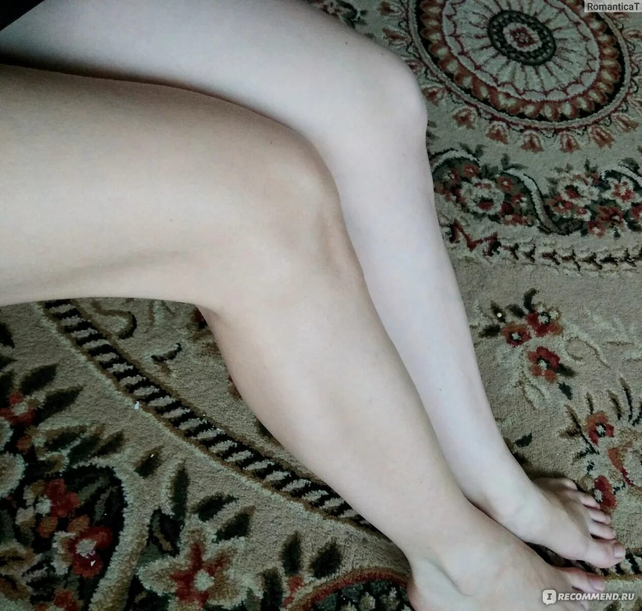 Бледные ноги. Бледные женские ноги. Бледные ступни ног. Холодные бледные ноги