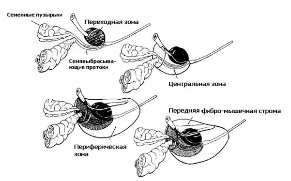 Схема простаты. Схема строения предстательной железы. Зональная анатомия предстательной железы по MCNEAL. Зоны предстательной железы схема. Строение предстательной железы анатомия мрт.