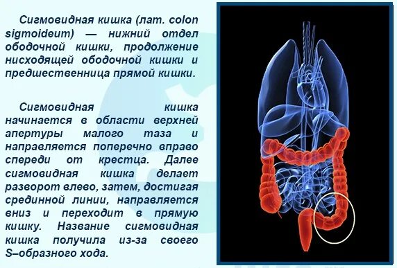 Сигма кишка. Воспаление сигмовидной кишки. Заболевания сигмовидной кишки. Сигмовидная кишка симптомы.