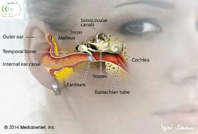 Дисфункция евстахиевой трубы. Нерв слуховой звон в ухе. Что такое в ухе тиннитус.