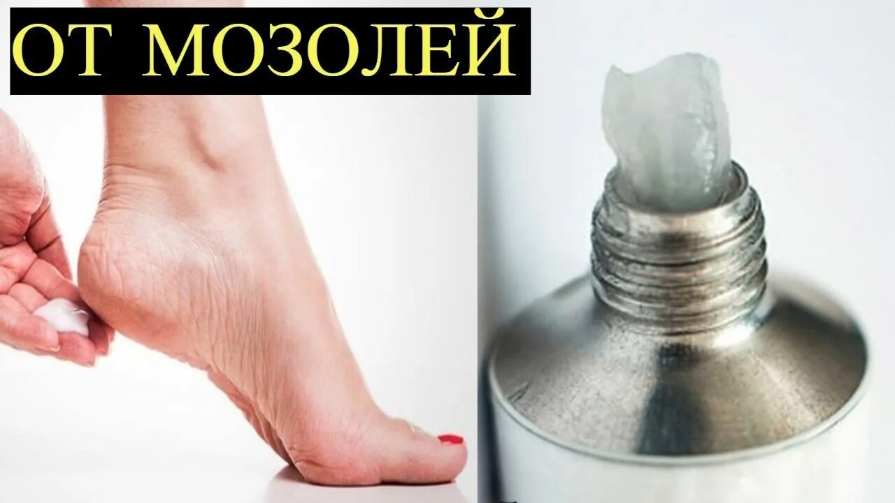 Сухой мозоль на пальце мазь. Между пальцами ног натоптыши мазь. мозолей и натоптышей между пальцами ног пермь. как избавиться от мозоли на пальце ноги мазь. средство полив мозоли на пальце ноги.