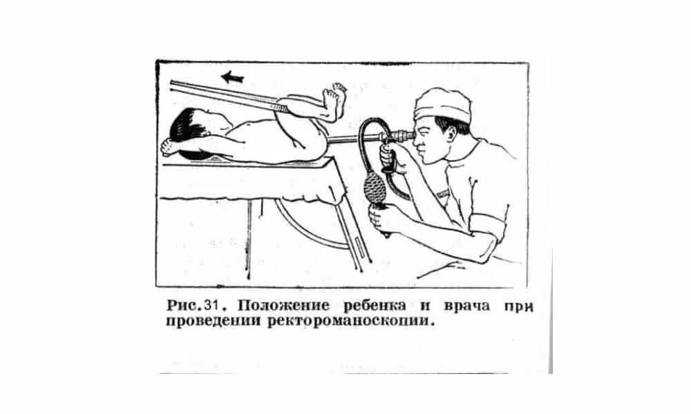 Подготовка к проктологу при геморрое. Исследование прямой кишки ректороманоскопия. Ректороманоскопия схема. Ректороманоскопия (ректоскопия). Ректоскоп для ректороманоскопии.