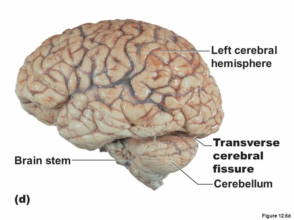 Brain down. Cerebrum анатомия. Cerebral Hemisphere. Церебрум мозг.