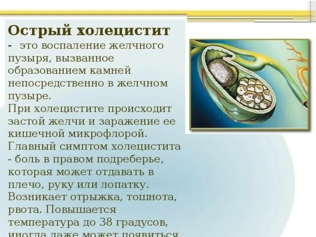 Застой желчного пузыря у взрослого симптомы. Холецистит желчного пузыря. При воспалении желчного. Желчный пузырь с камнем и воспалением.