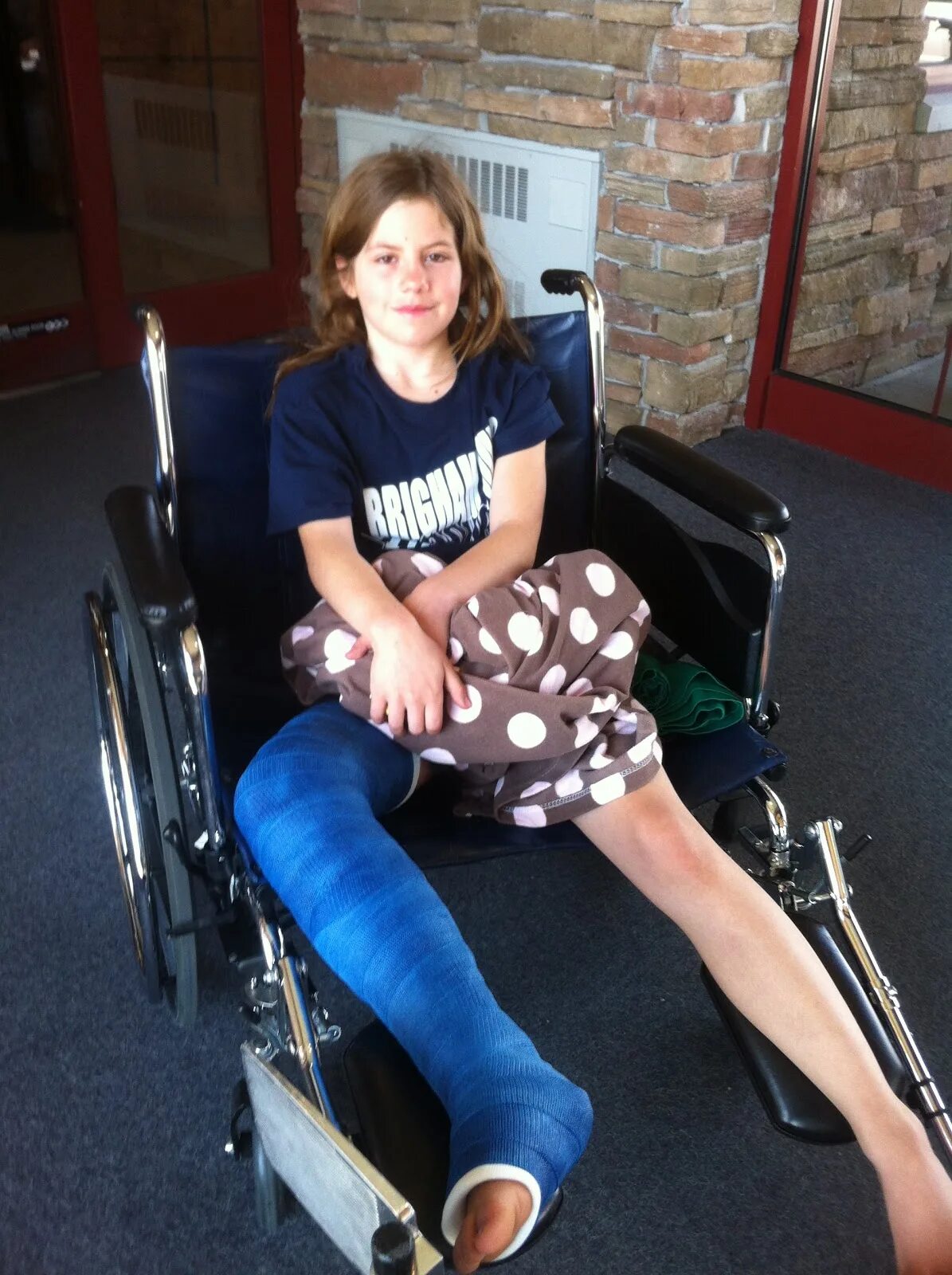 Double Leg Cast wheelchair. Long Leg Cast wheelchair. Full body Cast wheelchair. Cast leg