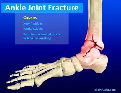 Fracture well