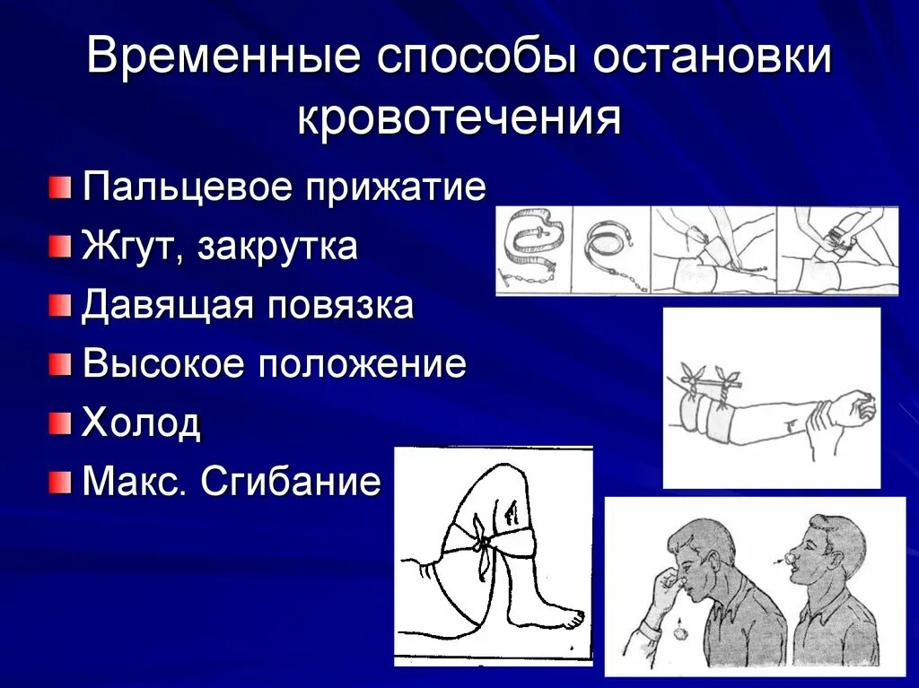 Методы остановки временных кровотечений. Способы остановки кровотечения. Способы временной остановки кровотечения. Временный способ остановки кровотечения.