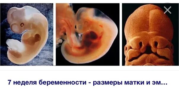 Симптомы на 6 неделе беременности